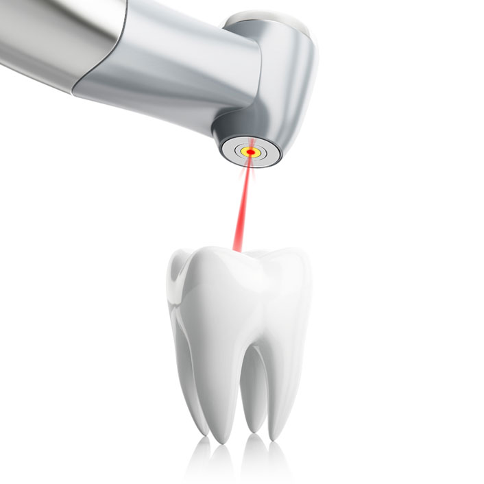 Laser dentistry - Dental Technology